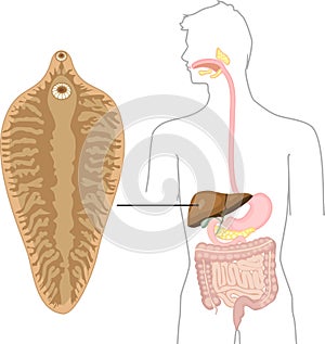 Sheep liver fluke Fasciola hepatica and structure of human digestive system. Location of helminth in body photo
